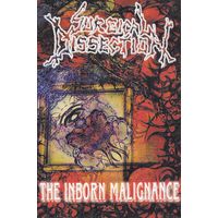 Surgical Dissection "The Inborn Malignance" кассета